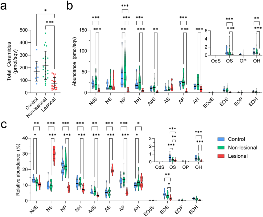 银屑病皮损真相:皮肤角质层神经酰胺图谱全解析